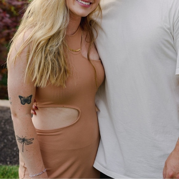 Women’s Abercrombie & Fitch Cutout Dress - Picture 2 of 5